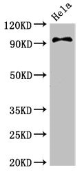 CSB-PA854108LA01HU