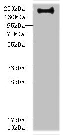 CSB-PA857021ESR1HU