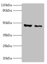 CSB-PA860767ESR1HU