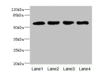 CSB-PA862061ESR2HU