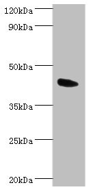 CSB-PA866314ESR2HU