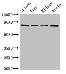 CSB-PA885738LA01HU