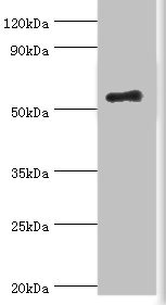 CSB-PA892336DSR1HU