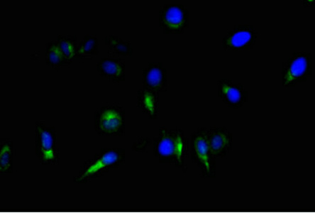 CSB-MA0157131A0m