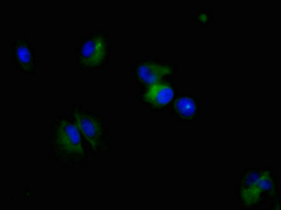 CSB-MA0157131A0m