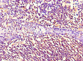 CSB-MA0157131A0m