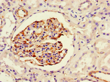 CSB-MA0157131A0m