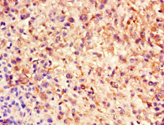 CSB-MA0157131A0m