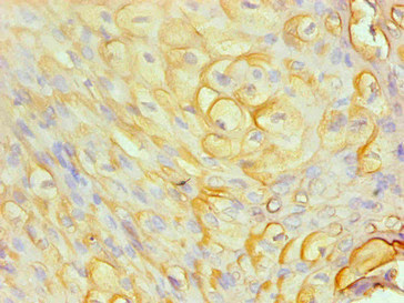 CSB-MA0206411A0m