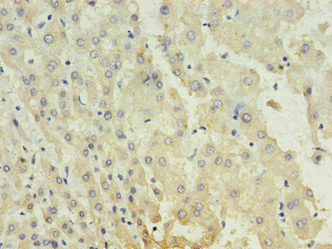 CSB-MA027711A0m