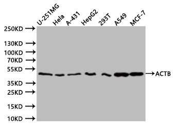CSB-RA000091M1m