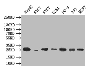 CSB-RA006163MA1HU WB