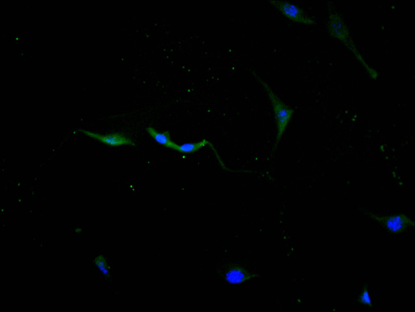 CSB-RA006193MA1HU
