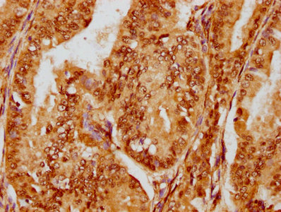 CSB-RA008836A0HU