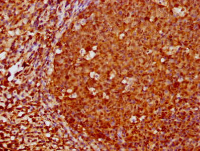 CSB-RA008836A0HU