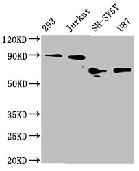 CSB-RA008836A0HU