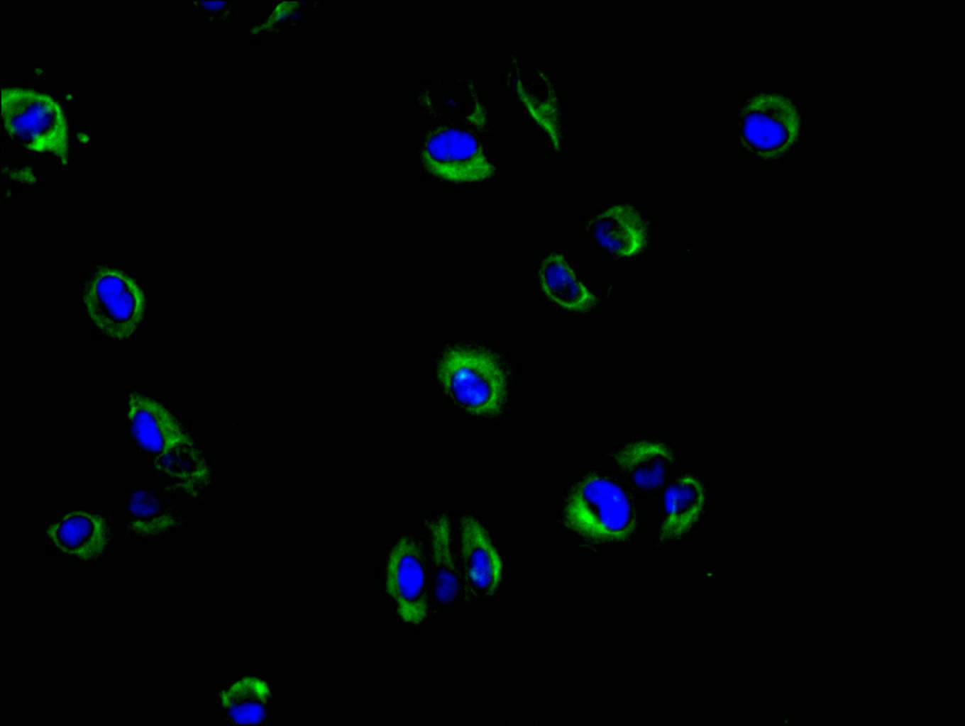 CSB-RA011649MA1HU