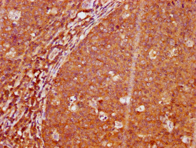 CSB-RA012767A191phHU