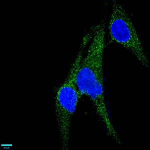 CSB-RA013563A0HU