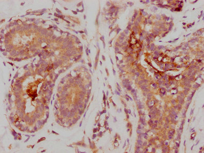 CSB-RA014679A0HU IHC
