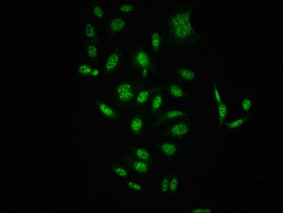 CSB-RA019284A621phHU