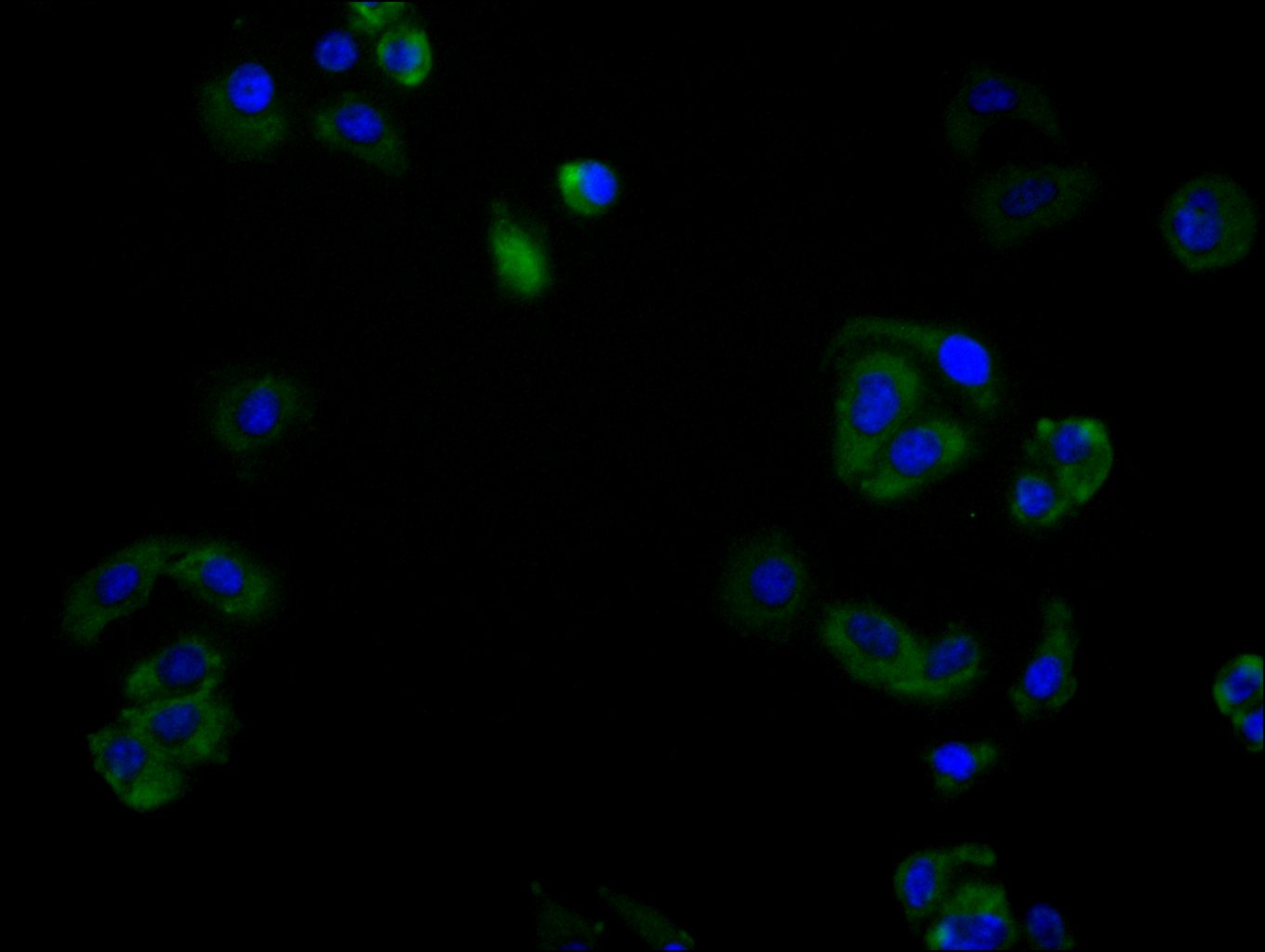 CSB-RA020888MA1HU