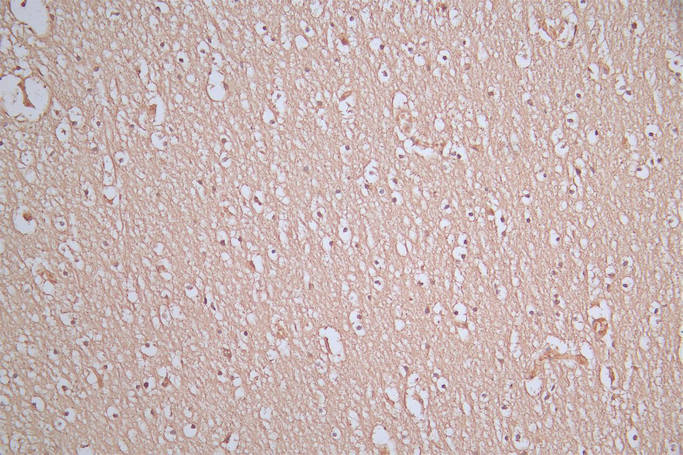 CSB-RA021912MA1HU