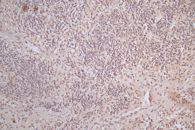 CSB-RA021912MA1HU