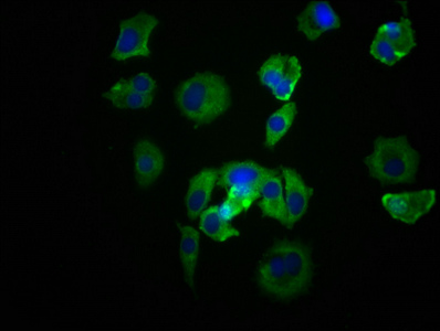 CSB-RA022650A0HU