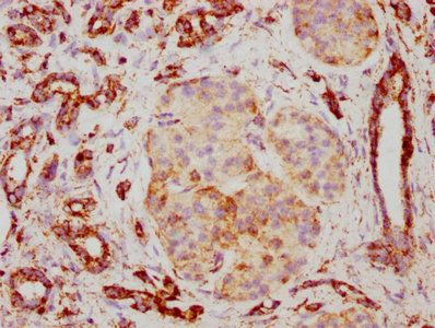 CSB-RA025168A0HU