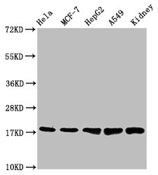CSB-RA025168A0HU