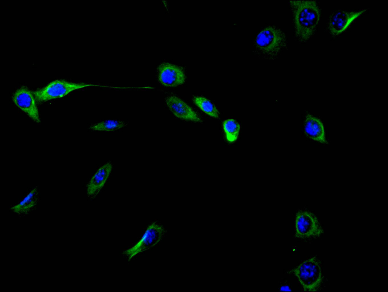 CSB-RA025857MA1HU