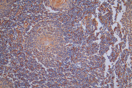 CSB-RA025857MA1HU