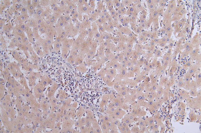 CSB-RA119753A0HU