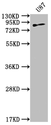 CSB-RA147681A0HU
