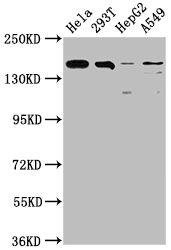 CSB-RA152430A0HU