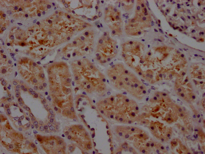 CSB-RA156066A0HU