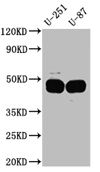 CSB-RA156066A0HU