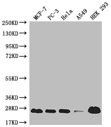 CSB-RA158563A0HU