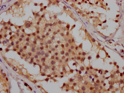 CSB-RA166706A0HU