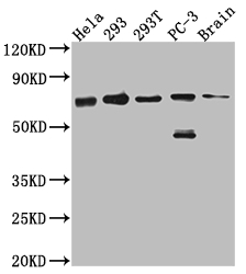 CSB-RA198749A0HU