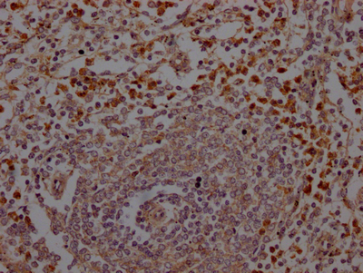 CSB-RA200985A0HU