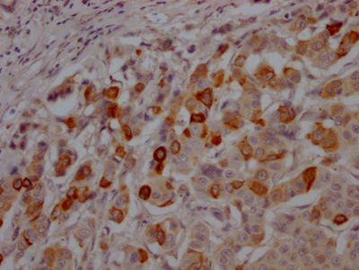 CSB-RA216259A0HU