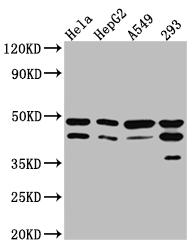 CSB-RA216259A0HU