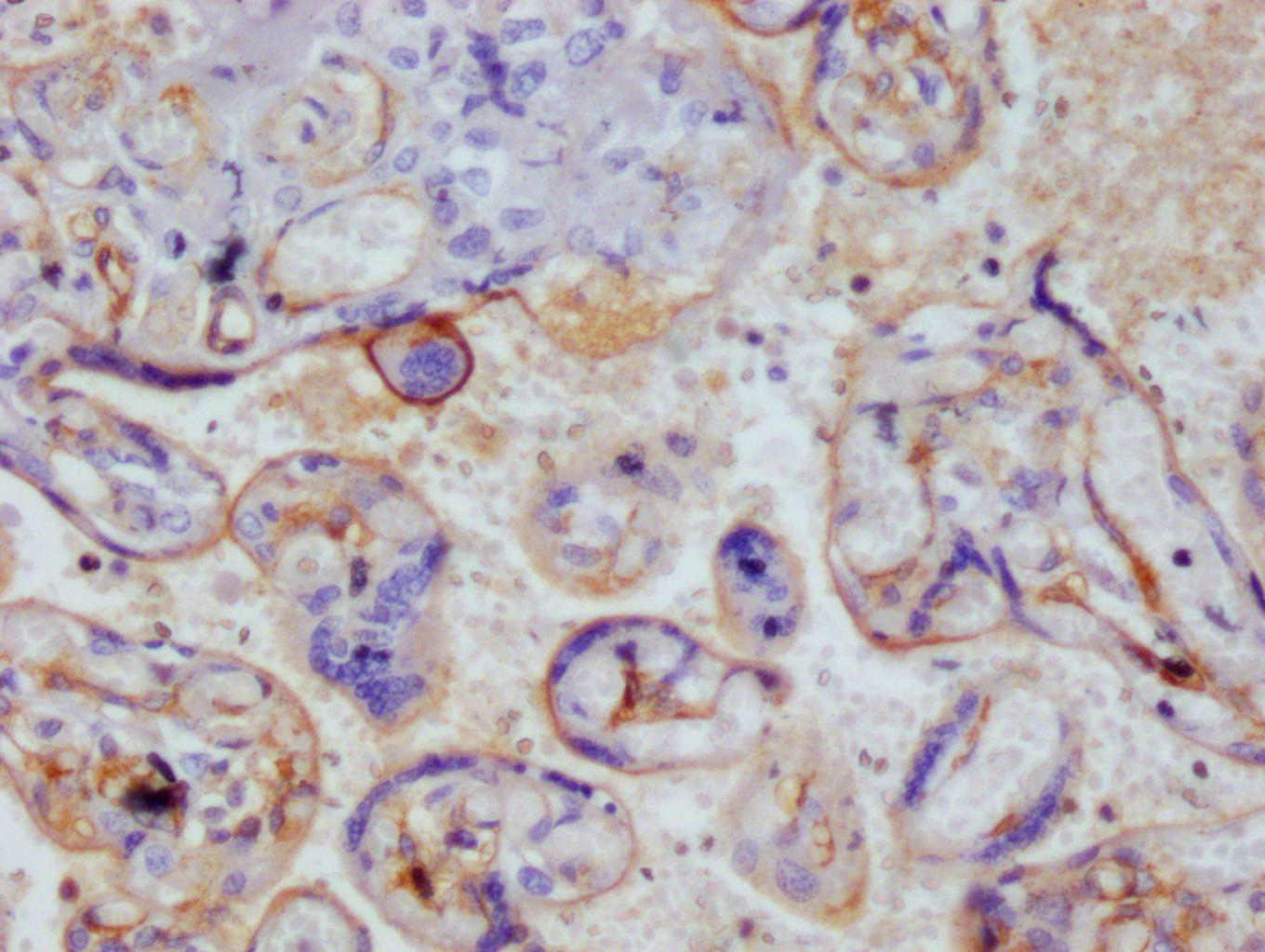 CSB-RA222792A0HU