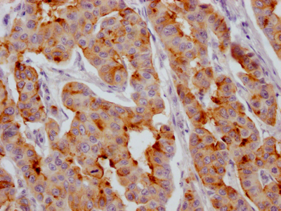 CSB-RA225697A0HU