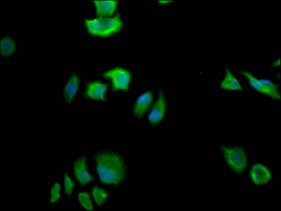 CSB-RA240595A0HU