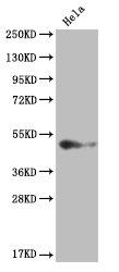 CSB-RA257673A0HU