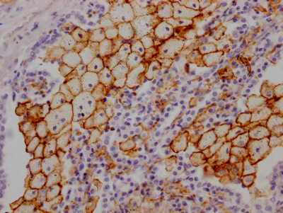 CSB-RA268157A0HU