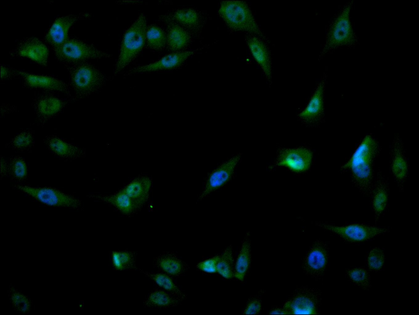 CSB-RA276081A0HU